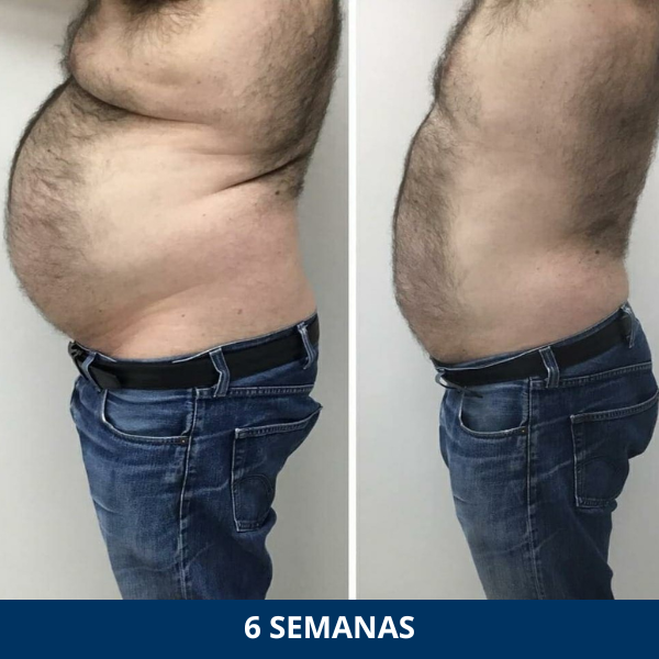 FiberPulse™ Chaleco Faja Quemador De Grasa